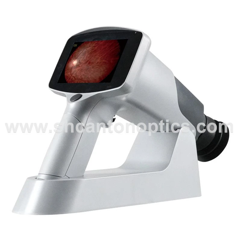 info-1-1 Auto Split Focusing Portable Fundus Camera